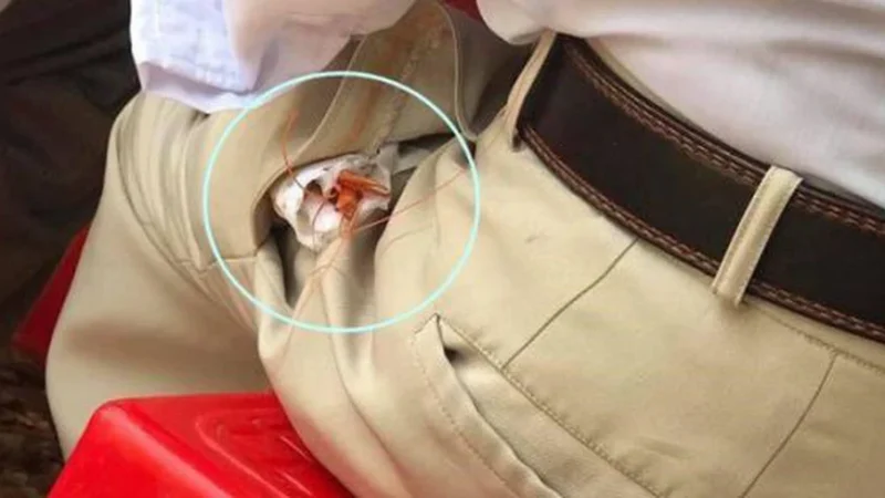 Con tôm trong túi và tình yêu của bố